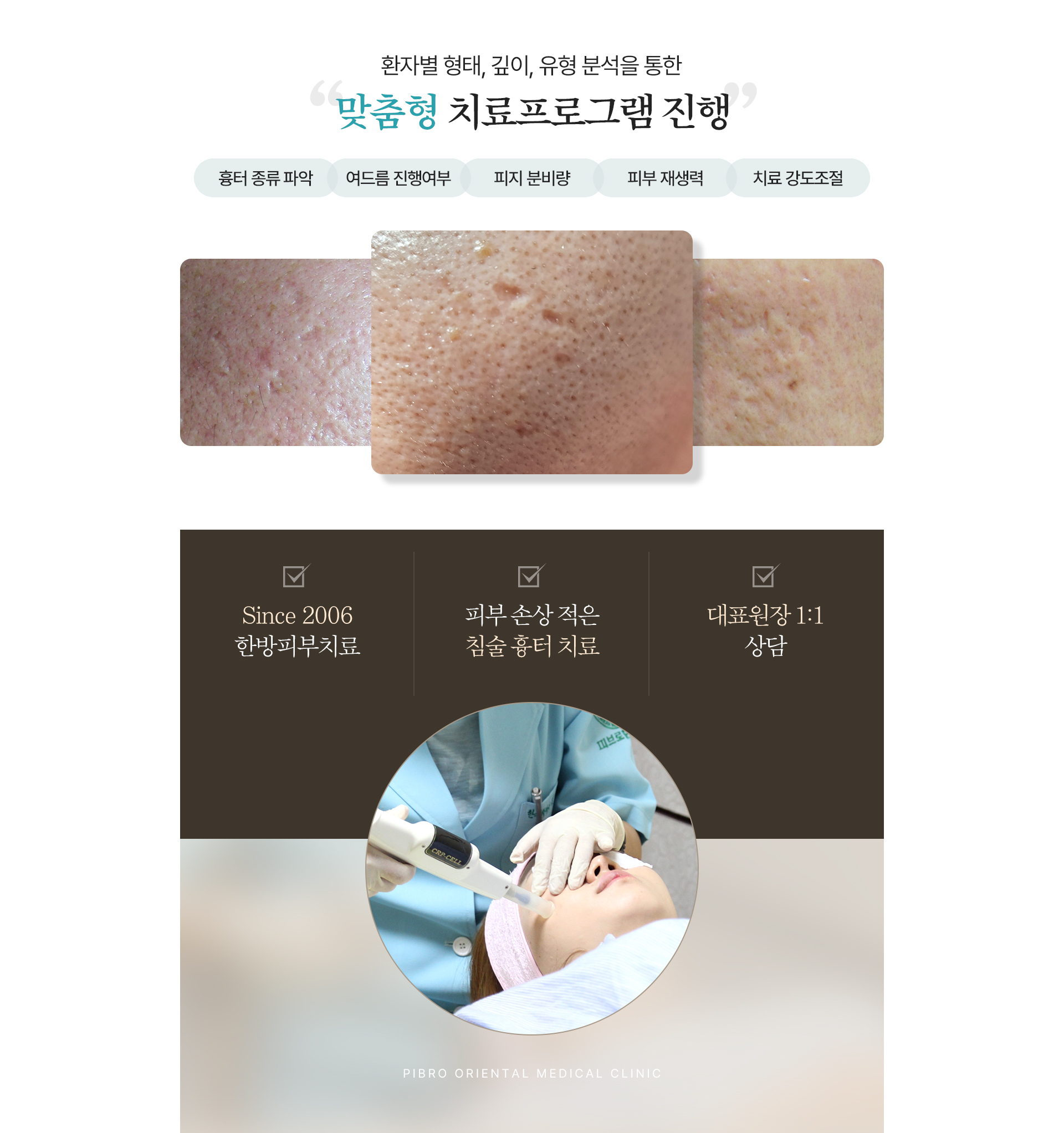 흉터,자국 치료