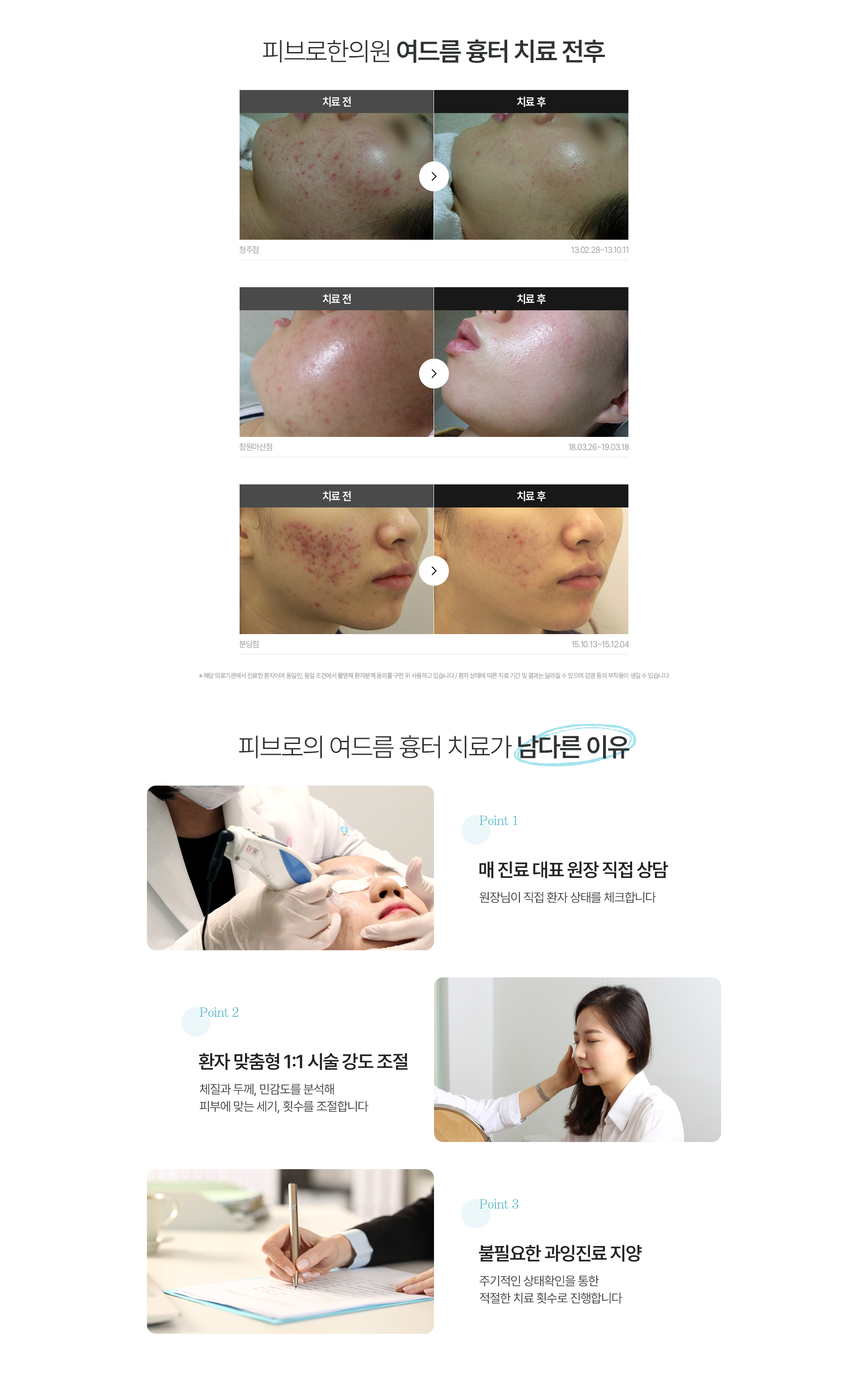 흉터,자국 치료